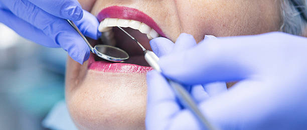 Best Emergency Wisdom Teeth Removal in Cedar Grove, FL