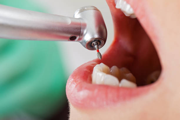 Best Emergency Broken Tooth Repair in Cedar Grove, FL